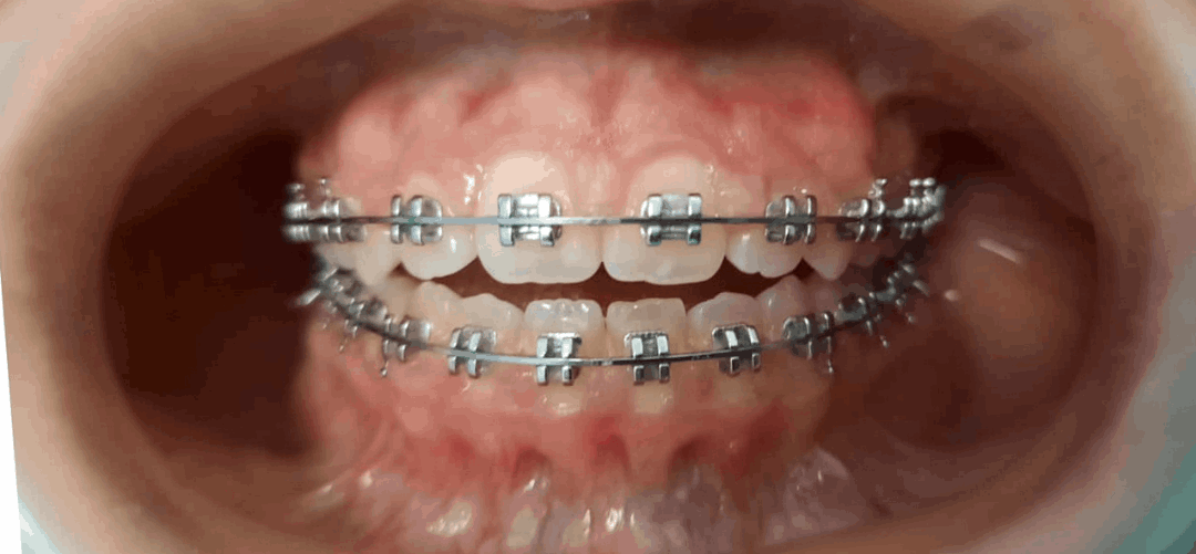 P2